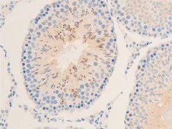 Invitrogen Phospho-IkappaB epsilon (Ser161) Polyclonal Antibody 100 &mu;L;