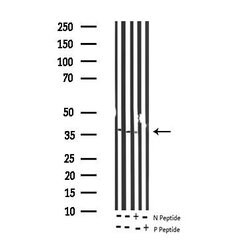 Invitrogen Phospho-IkappaB epsilon (Ser161) Polyclonal Antibody 100 &mu;L;