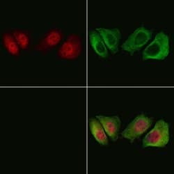 Invitrogen Phospho-HSP20 (Ser16) Polyclonal Antibody 100 &mu;L; Unconjugated:Antibodies,