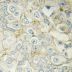 Invitrogen Phospho-HSP20 (Ser16) Polyclonal Antibody 100 &mu;L; Unconjugated:Antibodies,