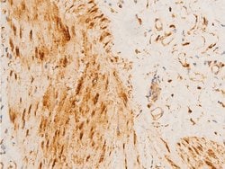 Invitrogen Phospho-HSP20 (Ser16) Polyclonal Antibody 100 &mu;L; Unconjugated:Antibodies,
