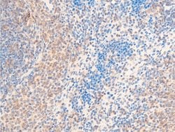 Invitrogen Phospho-HSP20 (Ser16) Polyclonal Antibody 100 &mu;L; Unconjugated:Antibodies,