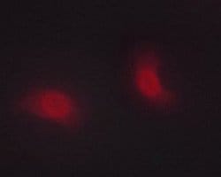 Invitrogen Phospho-Chk1 (Ser286) Polyclonal Antibody 100 &mu;L; Unconjugated:Antibodies,