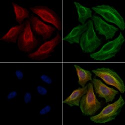 Invitrogen Phospho-IKK beta (Tyr188) Polyclonal Antibody 100 &mu;L | Buy Online | Invitrogen&trade; | Fisher Scientific