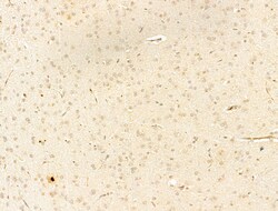 Invitrogen Phospho-IKK beta (Tyr188) Polyclonal Antibody 100 &mu;L | Buy Online | Invitrogen&trade; | Fisher Scientific