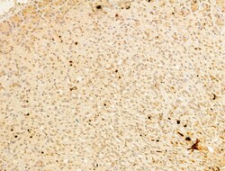 Invitrogen Phospho-IKK beta (Tyr188) Polyclonal Antibody 100 &mu;L | Buy Online | Invitrogen&trade; | Fisher Scientific