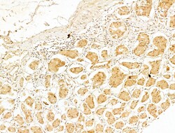 Invitrogen Phospho-IKK beta (Tyr188) Polyclonal Antibody 100 &mu;L | Buy Online | Invitrogen&trade; | Fisher Scientific