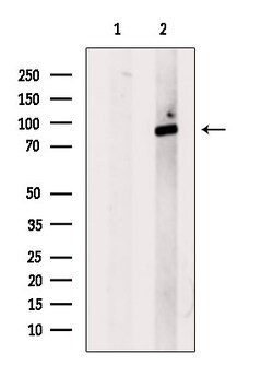 Invitrogen Phospho-IKK beta (Tyr188) Polyclonal Antibody 100 &mu;L | Buy Online | Invitrogen&trade; | Fisher Scientific