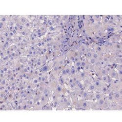 Invitrogen Phospho-IKK beta (Tyr188) Polyclonal Antibody 100 &mu;L | Buy Online | Invitrogen&trade; | Fisher Scientific