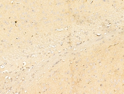 Phospho-IKK beta (Tyr199) Polyclonal Antibody:Antibodies, Polyclonal