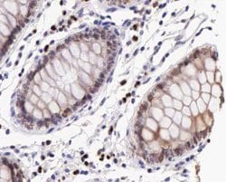 Phospho-IKK beta (Tyr199) Polyclonal Antibody:Antibodies, Polyclonal