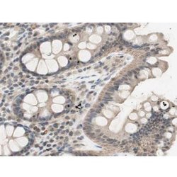 Invitrogen Phospho-IKK alpha (Thr23) Polyclonal Antibody 100 &mu;L; Unconjugated:Antibodies,