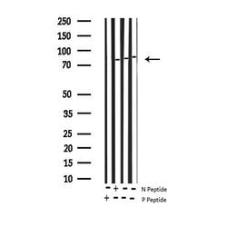 Invitrogen Phospho-IKK alpha (Thr23) Polyclonal Antibody 100 &mu;L; Unconjugated:Antibodies,