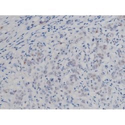 Invitrogen Phospho-IKK alpha/beta (Ser180, Ser181) Polyclonal Antibody 100 &mu;L | Buy Online | Invitrogen&trade; | Fisher Scientific
