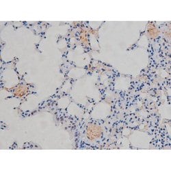 Invitrogen Phospho-IKK alpha/beta (Ser180, Ser181) Polyclonal Antibody 100 &mu;L | Buy Online | Invitrogen&trade; | Fisher Scientific