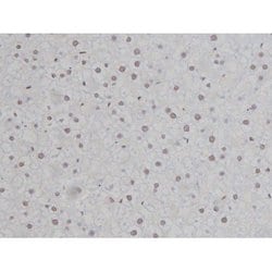 Invitrogen Phospho-IKK alpha/beta (Ser180, Ser181) Polyclonal Antibody 100 &mu;L | Buy Online | Invitrogen&trade; | Fisher Scientific