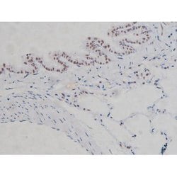 Invitrogen Phospho-IKK alpha/beta (Ser180, Ser181) Polyclonal Antibody 100 &mu;L | Buy Online | Invitrogen&trade; | Fisher Scientific