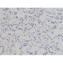 Invitrogen Phospho-IKK alpha/beta (Ser180, Ser181) Polyclonal Antibody 100 &mu;L | Buy Online | Invitrogen&trade; | Fisher Scientific