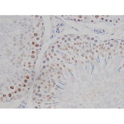 Invitrogen Phospho-IKK alpha/beta (Ser180, Ser181) Polyclonal Antibody 100 &mu;L | Buy Online | Invitrogen&trade; | Fisher Scientific
