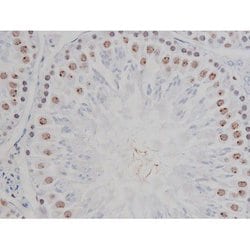 Invitrogen Phospho-IKK alpha/beta (Ser180, Ser181) Polyclonal Antibody 100 &mu;L | Buy Online | Invitrogen&trade; | Fisher Scientific
