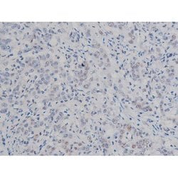 Invitrogen Phospho-IKK alpha/beta (Ser180, Ser181) Polyclonal Antibody 100 &mu;L | Buy Online | Invitrogen&trade; | Fisher Scientific