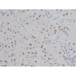 Invitrogen Phospho-IKK alpha/beta (Ser180, Ser181) Polyclonal Antibody 100 &mu;L | Buy Online | Invitrogen&trade; | Fisher Scientific