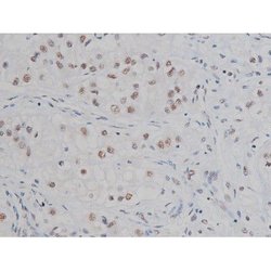 Invitrogen Phospho-IKK alpha/beta (Ser180, Ser181) Polyclonal Antibody 100 &mu;L | Buy Online | Invitrogen&trade; | Fisher Scientific