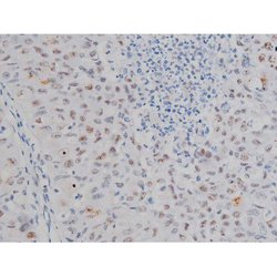 Invitrogen Phospho-IKK alpha/beta (Ser180, Ser181) Polyclonal Antibody 100 &mu;L | Buy Online | Invitrogen&trade; | Fisher Scientific