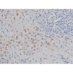 Invitrogen Phospho-IKK alpha/beta (Ser180, Ser181) Polyclonal Antibody 100 &mu;L | Buy Online | Invitrogen&trade; | Fisher Scientific