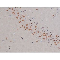 Invitrogen Phospho-IKK alpha/beta (Ser180, Ser181) Polyclonal Antibody 100 &mu;L | Buy Online | Invitrogen&trade; | Fisher Scientific