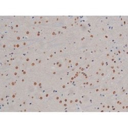 Invitrogen Phospho-IKK alpha/beta (Ser180, Ser181) Polyclonal Antibody 100 &mu;L | Buy Online | Invitrogen&trade; | Fisher Scientific