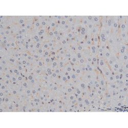 Invitrogen Phospho-IKK alpha/beta (Ser180, Ser181) Polyclonal Antibody 100 &mu;L | Buy Online | Invitrogen&trade; | Fisher Scientific