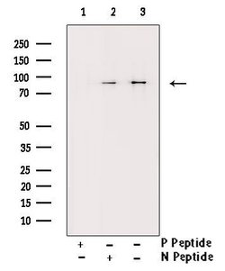 Invitrogen Phospho-IKK alpha/beta (Ser180, Ser181) Polyclonal Antibody 100 &mu;L | Buy Online | Invitrogen&trade; | Fisher Scientific