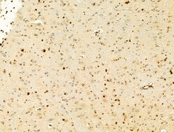 Invitrogen Phospho-IKK alpha/beta (Ser176, Ser177) Polyclonal Antibody