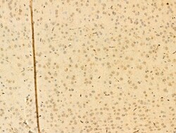 Invitrogen Phospho-IKK alpha/beta (Ser176, Ser177) Polyclonal Antibody