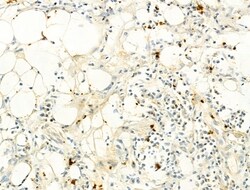 Invitrogen Phospho-IKK alpha/beta (Ser176, Ser177) Polyclonal Antibody