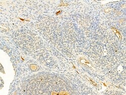 Invitrogen Phospho-IKK alpha/beta (Ser176, Ser177) Polyclonal Antibody