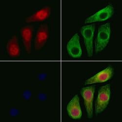 Invitrogen Phospho-IKK alpha/beta (Ser176, Ser177) Polyclonal Antibody