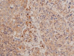 Invitrogen Phospho-IKK alpha/beta (Ser176, Ser177) Polyclonal Antibody
