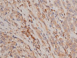 Invitrogen Phospho-IKK alpha/beta (Ser176, Ser177) Polyclonal Antibody