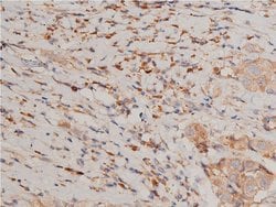 Invitrogen Phospho-IKK alpha/beta (Ser176, Ser177) Polyclonal Antibody