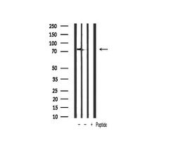 Invitrogen Phospho-IKK alpha/beta (Ser176, Ser177) Polyclonal Antibody
