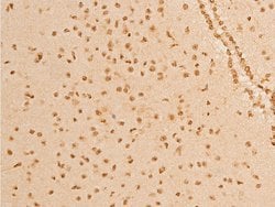 Invitrogen Phospho-p73 (Tyr99) Polyclonal Antibody 100 &mu;L; Unconjugated:Antibodies,