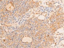 Invitrogen Phospho-p73 (Tyr99) Polyclonal Antibody 100 &mu;L; Unconjugated:Antibodies,