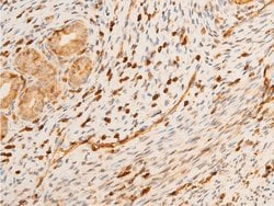Invitrogen Phospho-p73 (Tyr99) Polyclonal Antibody 100 &mu;L; Unconjugated:Antibodies,