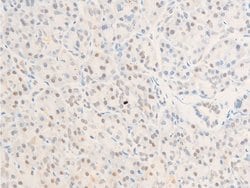 Invitrogen Phospho-Survivin (Thr117) Polyclonal Antibody 100 &mu;L | Buy Online | Invitrogen&trade; | Fisher Scientific