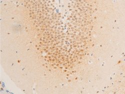 Invitrogen Phospho-Survivin (Thr117) Polyclonal Antibody 100 &mu;L | Buy Online | Invitrogen&trade; | Fisher Scientific