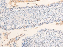 Invitrogen Phospho-Survivin (Thr117) Polyclonal Antibody 100 &mu;L | Buy Online | Invitrogen&trade; | Fisher Scientific
