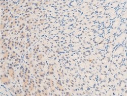 Invitrogen Phospho-Survivin (Thr117) Polyclonal Antibody 100 &mu;L | Buy Online | Invitrogen&trade; | Fisher Scientific