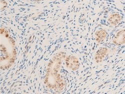 Invitrogen Phospho-Survivin (Thr117) Polyclonal Antibody 100 &mu;L | Buy Online | Invitrogen&trade; | Fisher Scientific